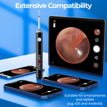 EarXpert™ Visual Ear Wax Cleaner