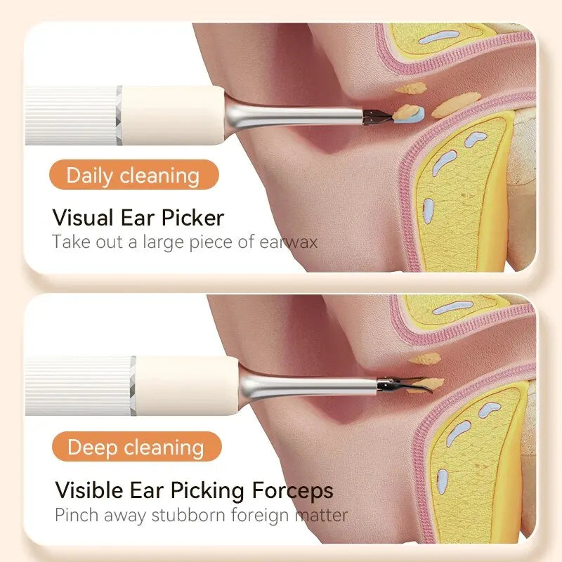 EarXpert™ 3 in 1 Visual Ear Cleaner With Picking Tweezers