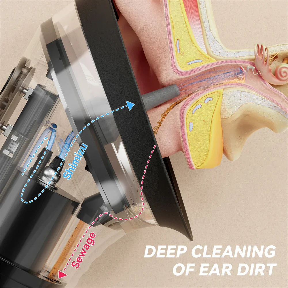 Electric Ear Wax Removal System Water Powered Ear Cleaning Tool with Irrigation Flusher 3 Pressure Settings Safe & Effective