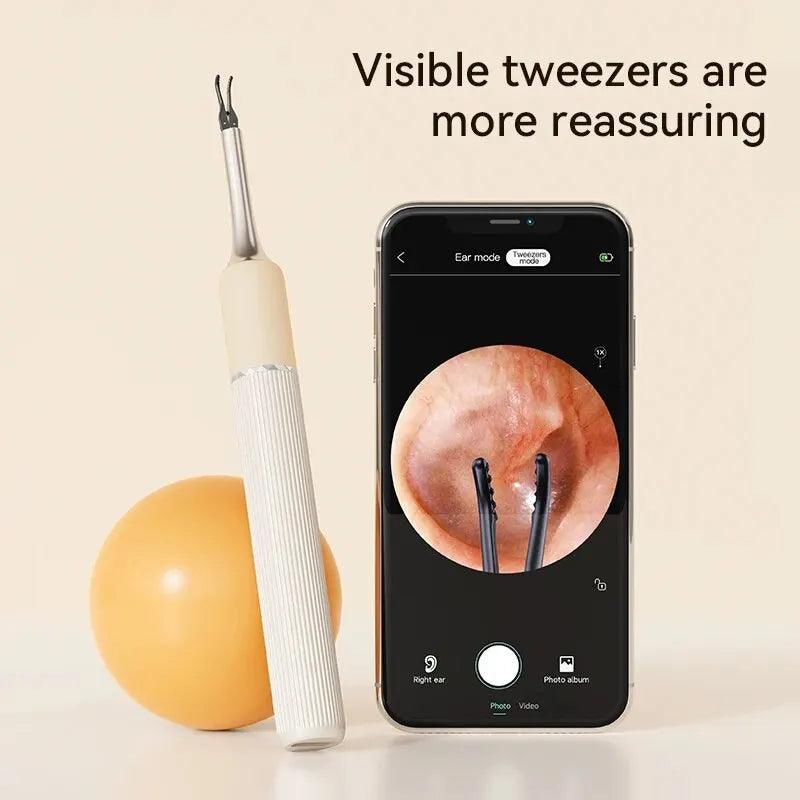 EarXpert™ 3 in 1 Visual Ear Cleaner With Picking Tweezers - EarXpert 